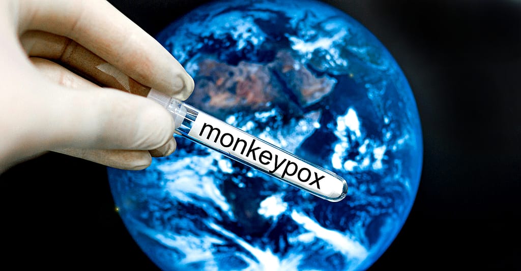 monkeypox on schedule